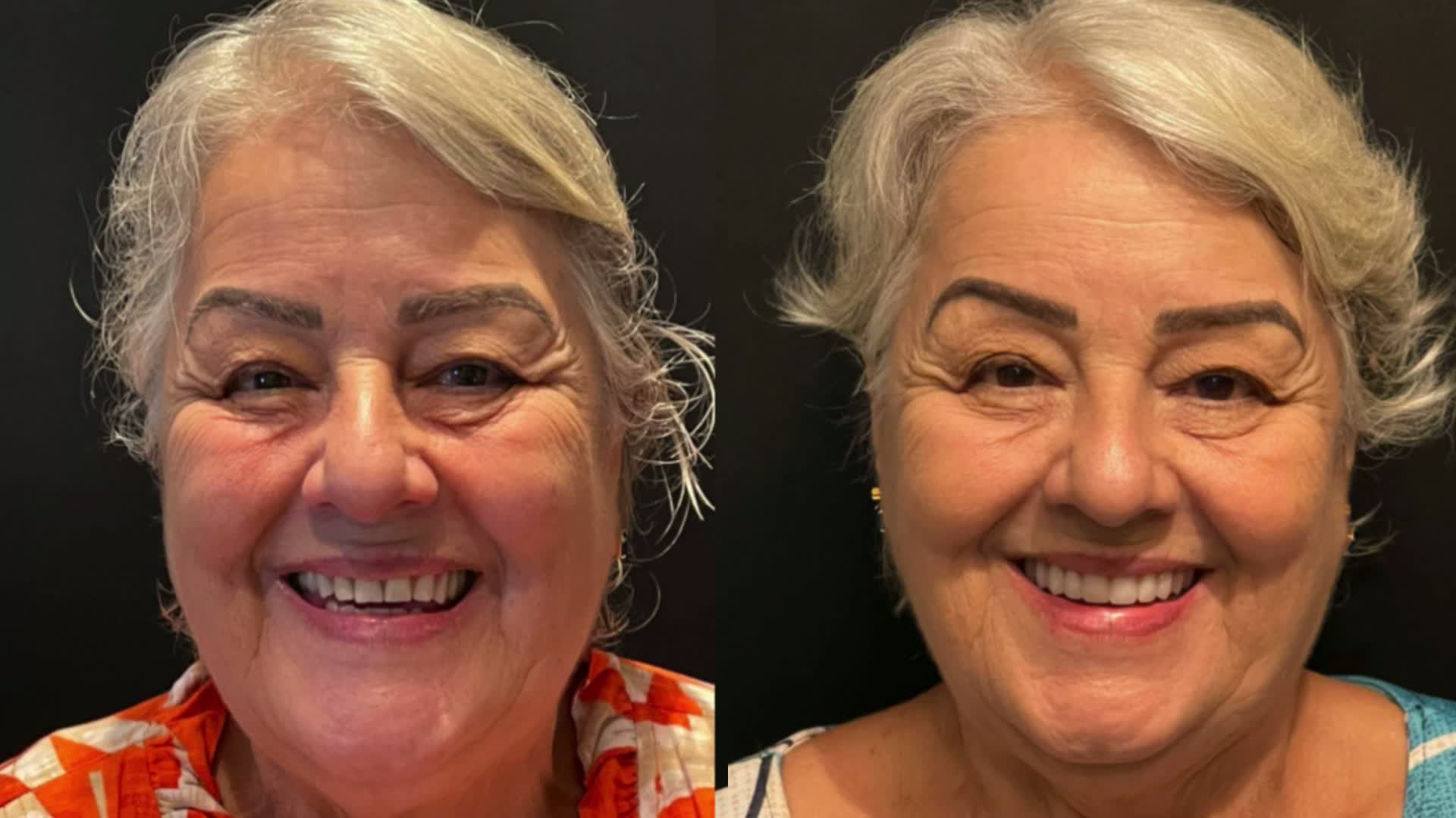Caso clínico — antes e depois 1