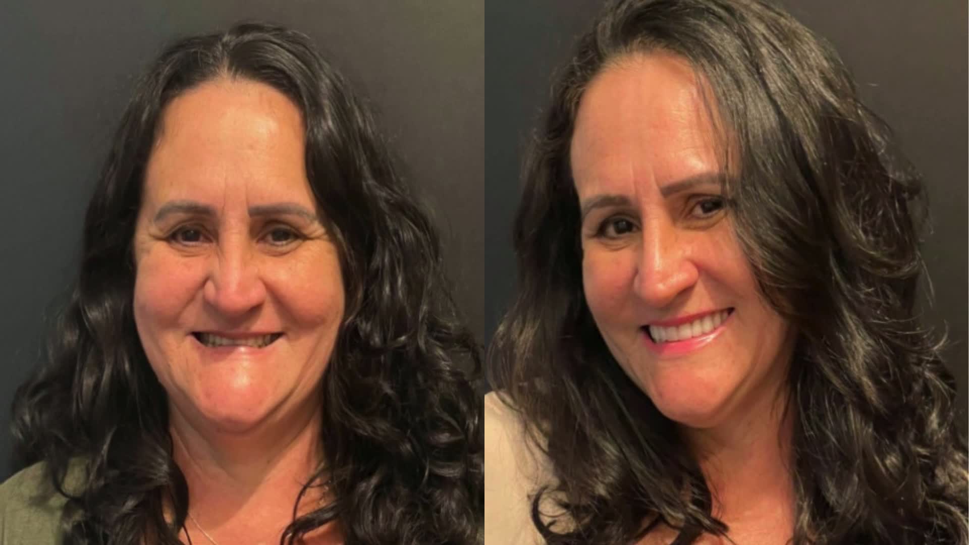 Caso clínico — antes e depois 2