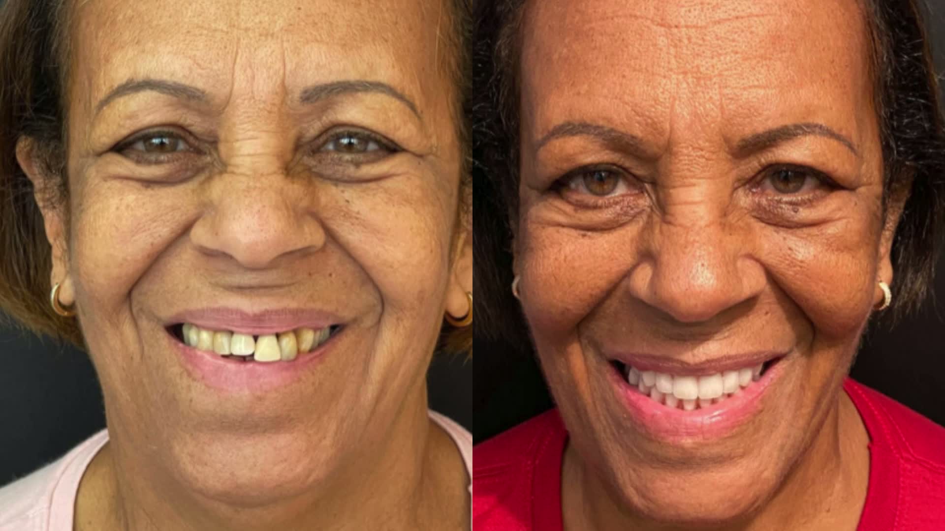 Caso clínico — antes e depois 5